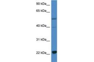 Image no. 1 for anti-Interleukin 18 (IL18) (C-Term) antibody (ABIN6746899) (IL-18 anticorps  (C-Term))