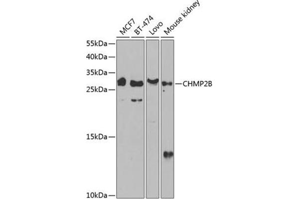 CHMP2B anticorps  (AA 1-213)