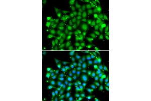 Immunofluorescence analysis of MCF-7 cells using SUFU antibody (ABIN6133029, ABIN6148692, ABIN6148694 and ABIN6217424). (SUFUH anticorps  (AA 325-484))