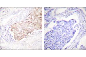 Peptide - + (UBR5 anticorps)