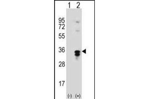 Western blot analysis of T1 (arrow) using rabbit polyclonal T1 Antibody  (ABIN389117 and ABIN2839303). (PPT1 anticorps  (C-Term))