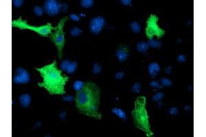 Immunofluorescence (IF) image for anti-Cerebral Cavernous Malformation 2 (CCM2) antibody (ABIN1497135) (CCM2 anticorps)