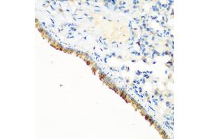 Immunohistochemistry of paraffin-embedded mouse lung using CBL antibody. (CBL anticorps)