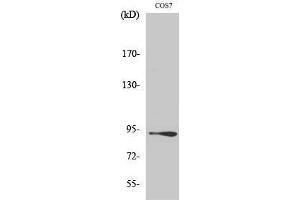 Western Blotting (WB) image for anti-Catenin, beta (CATNB) (Ser29) antibody (ABIN3183685) (beta Catenin anticorps  (Ser29))