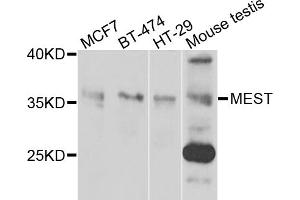 Western blot analysis of extracts of various cell lines, using MEST antibody (ABIN5974168) at 1/1000 dilution. (MEST anticorps)