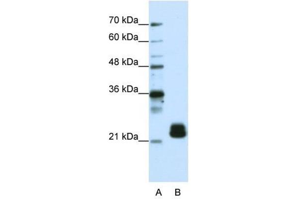 TMED4 anticorps  (N-Term)