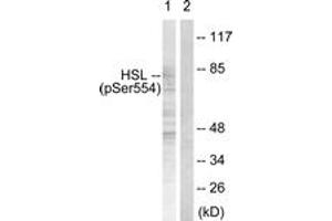 Western blot analysis of extracts from HeLa cells treated with Adriamycin 0. (LIPE anticorps  (pSer855))