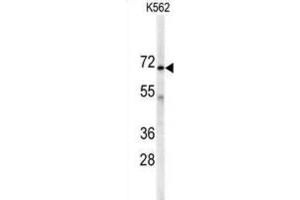 Western Blotting (WB) image for anti-Adenylate Kinase 7 (AK7) antibody (ABIN3002976) (Adenylate Kinase 7 anticorps)