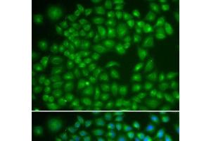Immunofluorescence analysis of MCF-7 cells using RAB4A Polyclonal Antibody (Rab4 anticorps)