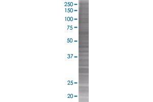 NUDT2 transfected lysate (NUDT2 293T Cell Transient Overexpression Lysate(Denatured))