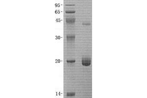 Validation with Western Blot (BID Protein (Transcript Variant 2))