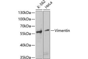 Western blot analysis of extracts of various cell lines, using Vimentin antibody (ABIN3016291, ABIN3016292, ABIN3016293 and ABIN6219693) at 1:1000 dilution. (Vimentin anticorps  (AA 1-200))