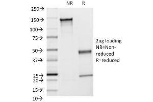 SDS-PAGE Analysis Purified CD54 Monoclonal Antibody (F4-31C2). (ICAM1 anticorps)