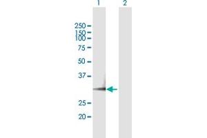 Western Blot analysis of PSME3 expression in transfected 293T cell line by PSME3 MaxPab polyclonal antibody. (PSME3 anticorps  (AA 1-254))