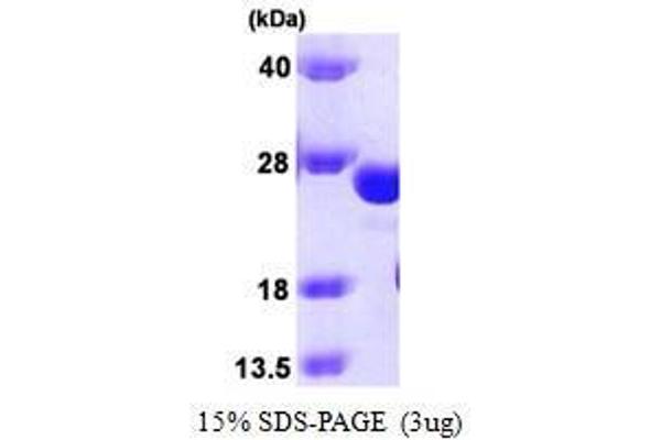 GSTK1 Protein (AA 1-226)