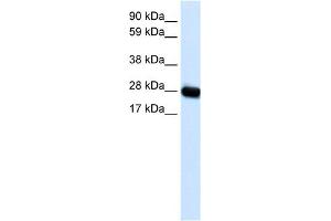 WB Suggested Anti-CAV3 Antibody Titration:  0. (Caveolin 3 anticorps  (N-Term))