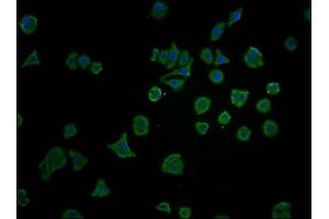 Immunofluorescence staining of HepG2 cells with ABIN7172751 at 1:100, counter-stained with DAPI. (YAP1 anticorps  (AA 155-504))