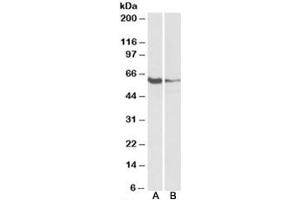 Western blot testing of human tonsil [A] and Daudi [B] lysates with FCRL2 antibody at 1ug/ml. (FCRL2 anticorps)