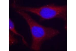Immunofluorescence staining of methanol-fixed Hela cells, using Phospho-PTPN6-Y536 antibody. (SHP1 anticorps  (pTyr536))