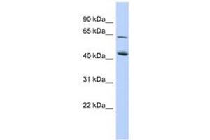 Image no. 1 for anti-NAD Kinase 2, Mitochondrial (NADK2) (AA 215-264) antibody (ABIN6741229) (NADK2 anticorps  (AA 215-264))