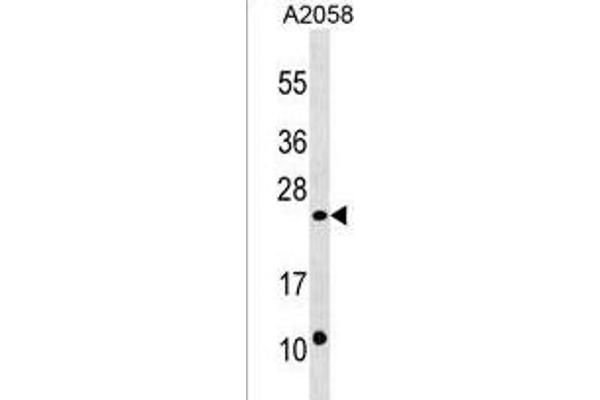 DUSP13 anticorps  (C-Term)