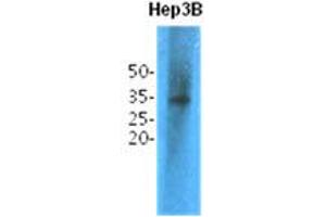 Western Blotting (WB) image for anti-Thiopurine S-Methyltransferase (TPMT) antibody (ABIN781550) (TPMT anticorps)
