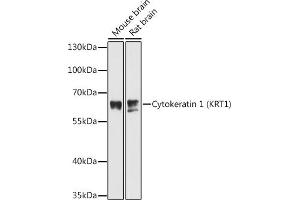 Western blot analysis of extracts of various cell lines, using Cytokeratin 1 (Cytokeratin 1 (KRT1)) antibody (ABIN6127738, ABIN6143011, ABIN6143012 and ABIN6215521) at 1:3000 dilution. (Cytokeratin 1 anticorps  (AA 200-450))