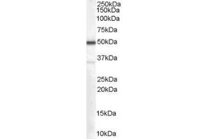Western Blotting (WB) image for anti-Chromosome 4 Open Reading Frame 3 (C4ORF3) (Middle Region) antibody (ABIN2156498) (C4ORF3 anticorps  (Middle Region))
