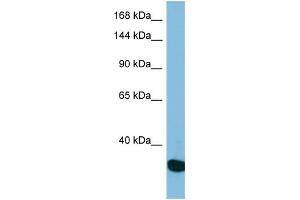 Western Blotting (WB) image for anti-Ubiquitin Specific Peptidase 36 (USP36) (N-Term) antibody (ABIN2501016) (USP36 anticorps  (N-Term))