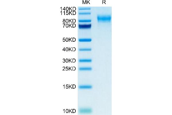 PODXL2 Protein (AA 29-499) (His tag)