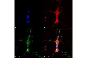 Immunocytochemistry/Immunofluorescence analysis using Mouse Anti-TrpC7 Monoclonal Antibody, Clone N64A/36 (ABIN2485430). (TRPC7 anticorps  (AA 845-862) (FITC))