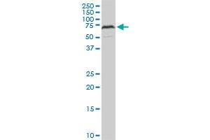 Western Blotting (WB) image for anti-Histone Deacetylase 1 (HDAC1) (AA 1-482) antibody (ABIN516392)