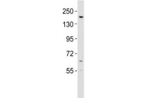 Western blot testing of KDM6B antibody at 1:2000 dilution + mouse lung lysate (Kdm6b anticorps  (AA 879-912))