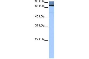 Human Liver; WB Suggested Anti-ADAD2 Antibody Titration: 0. (ADAD2 anticorps  (Middle Region))