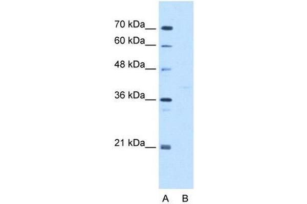 GMPPB anticorps  (C-Term)