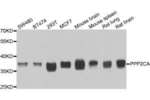 Western blot analysis of extracts of various cell lines, using PPP2CA antibody. (PPP2CA anticorps)