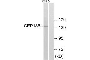 Western blot analysis of extracts from COLO cells, using CEP135 antibody. (CEP135 anticorps)