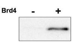 Image no. 1 for anti-Cyclin-Dependent Kinase 9 (CDK9) (pThr29) antibody (ABIN292281) (CDK9 anticorps  (pThr29))