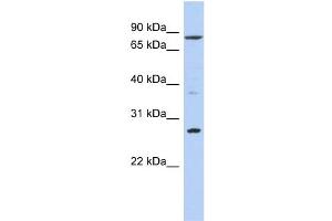 WB Suggested Anti-KLF12 Antibody Titration:  0. (KLF12 anticorps  (N-Term))