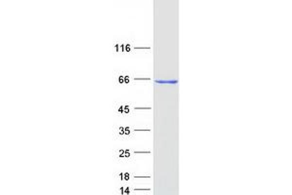 NAD-ME Protein (Myc-DYKDDDDK Tag)