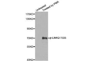 Western blot analysis of extracts from HeLa cells, using Phospho-LIMK2-T505 antibody (ABIN2988124). (LIMK2 anticorps  (pThr505))