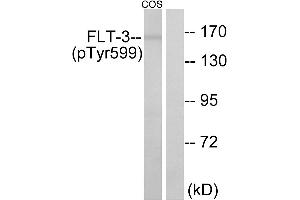 Western blot analysis of extracts from COS7 cells, treated with EGF (200ng/ml, 30mins), using FLT3 (Phospho-Tyr599) antibody. (FLT3 anticorps  (pTyr599))