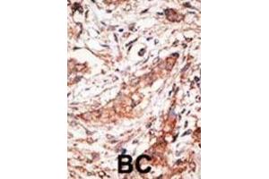 Immunohistochemistry (IHC) image for anti-Docking Protein 4 (DOK4) antibody (ABIN3003434) (DOK4 anticorps)