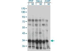 Western blot analysis of HMG20B in extracts from 293T, HeLa and A549 cell using anti-HMG20B monoclonal antibody. (HMG20B anticorps  (AA 1-109))