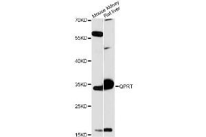 Western blot analysis of extracts of various cell lines, using QPRT antibody (ABIN6290813) at 1:3000 dilution. (QPRT anticorps)