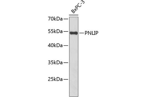 PNLIP anticorps  (AA 166-465)