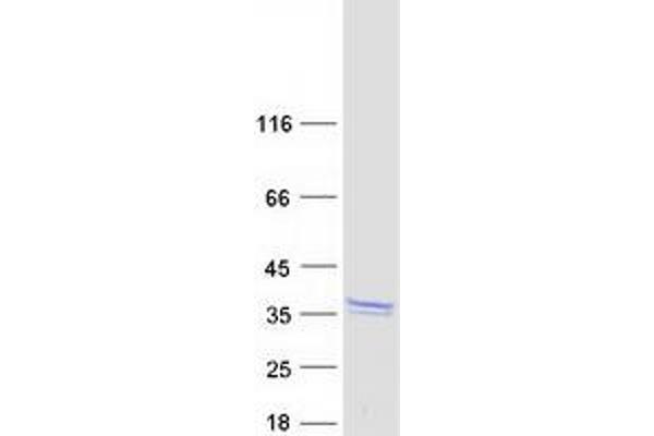 LDOC1L Protein (Myc-DYKDDDDK Tag)