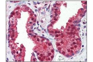 Immunohistochemistry (IHC) image for anti-Folate Hydrolase (Prostate-Specific Membrane Antigen) 1 (FOLH1) (AA 117-351) antibody (ABIN317555) (PSMA anticorps  (AA 117-351))