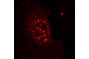 Image no. 3 for anti-V-Akt Murine Thymoma Viral Oncogene Homolog 1 (AKT1) (pThr308) antibody (ABIN196711) (AKT1 anticorps  (pThr308))