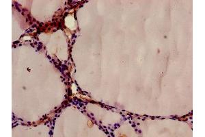 Immunohistochemistry of paraffin-embedded human thyroid tissue using ABIN7144296 at dilution of 1:100 (Annexin A9 anticorps  (AA 8-345))